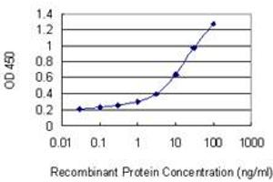 Detection limit for recombinant GST tagged SLC39A13 is 0. (SLC39A13 antibody  (AA 170-226))