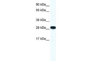 WB Suggested Anti-ZFP36L1 Antibody Titration: 0. (ZFP36L1 antibody  (N-Term))