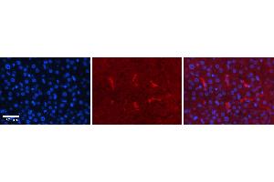 Immunohistochemistry (IHC) image for anti-Cyclin-Dependent Kinase 2 (CDK2) (Middle Region) antibody (ABIN2779325)