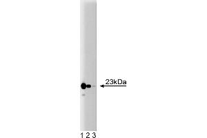 Western Blotting (WB) image for anti-Translocase of Inner Mitochondrial Membrane 23 Homolog (Yeast) (TIMM23) (AA 5-126) antibody (ABIN968428) (TIMM23 antibody  (AA 5-126))