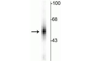 Western blot of human dorsal Raphe nucleus showing specific immunolabeling of the ~55 kDa tryptophan hydroxylase protein. (Tryptophan Hydroxylase 1 antibody)