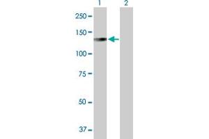 Western Blot analysis of LONP1 expression in transfected 293T cell line by LONP1 MaxPab polyclonal antibody. (LONP1 antibody  (AA 1-959))