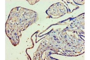 Immunohistochemistry of paraffin-embedded human placenta tissue using ABIN7157756 at dilution of 1:100 (KMO antibody  (AA 1-486))