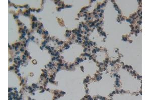 IHC-P analysis of Rat Lung Tissue, with DAB staining. (LIFR antibody  (AA 642-791))