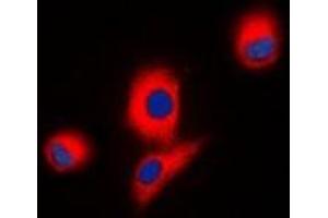 Immunofluorescent analysis of ICK staining in HEK293T cells. (ICK antibody)