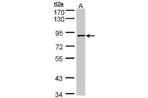 WB Image Sample (30 ug of whole cell lysate) A: A431 7. (SCYL3 antibody  (Center))