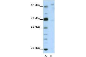 WB Suggested Anti-GLIS3 Antibody Titration:  2. (GLIS3 antibody  (N-Term))