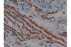 Immunohistochemistry (IHC) image for anti-Keratin 4 (KRT4) (AA 152-457) antibody (ABIN7431875)