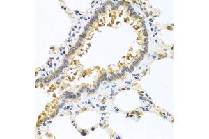 Immunohistochemistry of paraffin-embedded rat lung using CPA1 antibody. (CPA1 antibody)