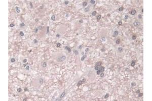 Immunohistochemistry (IHC) image for anti-Phospholipase D (PLD) (AA 725-1074) antibody (ABIN7434611)