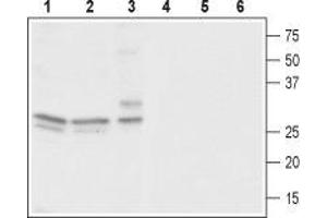 Western blot analysis of rat brain (lanes 1 and 4), mouse brain (lanes 2 and 5) and human neuroblastoma (SH-SY5Y) cells (lanes 3 and 6): - 1-3. (CACNG3 antibody  (C-Term, Intracellular))