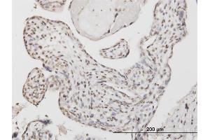 Immunoperoxidase of monoclonal antibody to ATF1 on formalin-fixed paraffin-embedded human placenta. (AFT1 antibody  (AA 1-271))