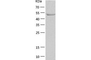 Western Blotting (WB) image for Cerebellar Degeneration-Related Protein 2, 62kDa (CDR2) (AA 1-454) protein (His tag) (ABIN7286920) (CDR2 Protein (AA 1-454) (His tag))