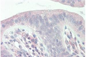 Human Colon: Formalin-Fixed, Paraffin-Embedded (FFPE) (CHP antibody  (AA 35-84))