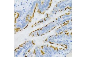 Immunohistochemistry of paraffin-embedded mouse lung using PTGER2 Antibody (ABIN5971508) at dilution of 1/100 (40x lens). (PTGER2 antibody)
