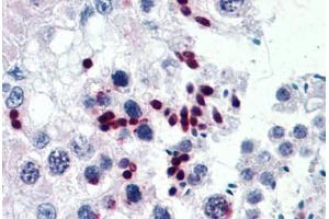 Human Testis: Formalin-Fixed, Paraffin-Embedded (FFPE) (CGGBP1 antibody  (AA 58-168))
