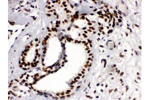 Immunohistochemistry (IHC) image for anti-Tripartite Motif Containing 28 (TRIM28) (AA 699-835) antibody (ABIN3043491)