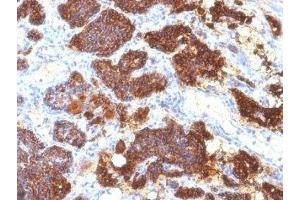 Formalin-fixed, paraffin-embedded human parathyroid stained with PTH antibody (PTH/1175). (PTH antibody  (AA 32-115))