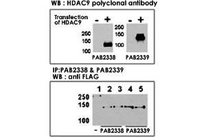 Both anti-HDAC9 N-term  and C-term  polyclonal antibody were tested by WB and IP-WB using HeLa and HeLa-HDAC9 transfected cells. (HDAC9 antibody  (C-Term))