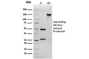 SDS-PAGE Analysis Purified CDX2 Mouse Monoclonal Antibody (rCDX2/1690). (Recombinant CDX2 antibody  (AA 150-249))