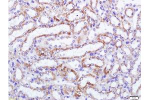 Paraformaldehyde-fixed, paraffin embedded mouse kidney tissue, Antigen retrieval by boiling in sodium citrate buffer(pH6) for 15min, Block endogenous peroxidase by 3% hydrogen peroxide for 30 minutes, Blocking buffer (normal goat serum) at 37°C for 20min, Antibody incubation with MCSF Receptor Polyclonal Antibody, Unconjugated  at 1:500 overnight at 4°C, followed by a conjugated secondary and DAB staining (CSF1R antibody  (AA 201-300))