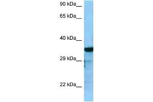 WB Suggested Anti-RGS4 Antibody Titration: 1.