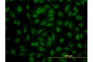 Immunofluorescence of monoclonal antibody to YY1 on HeLa cell. (YY1 antibody  (AA 221-320))