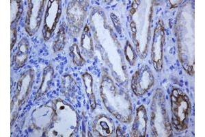 Image no. 2 for anti-Keratin 5 (KRT5) (AA 1-273) antibody (ABIN1490696) (Cytokeratin 5 antibody  (AA 1-273))