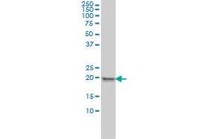MPHOSPH6 monoclonal antibody (M01), clone 1D8-2A8 Western Blot analysis of MPHOSPH6 expression in HeLa . (MPHOSPH6 antibody  (AA 1-160))
