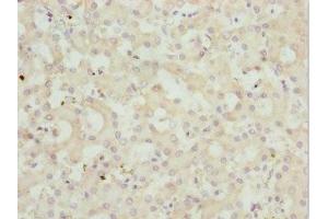 Immunohistochemistry of paraffin-embedded human liver tissue using ABIN7162962 at dilution of 1:100 (PEX3 antibody  (AA 144-373))