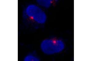 anti-Centrosomal Protein 290kDa (CEP290) (AA 2429-2479) antibody