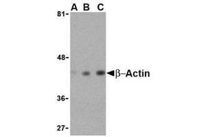 Western blot analysis of beta-actin in HeLa cell lysate with AP30136PU-N beta-actin antibody at (A) 0.
