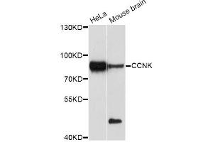 Western blot analysis of extracts of various cell lines, using CCNK Antibody (ABIN5997384) at 1/1000 dilution. (Cyclin K antibody)