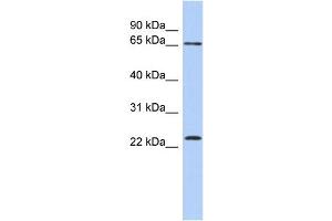 WB Suggested Anti-ZNF428 Antibody Titration: 0. (ZNF428 antibody  (N-Term))