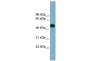 WB Suggested Anti-ABHD12 Antibody Titration:  0. (ABHD12 antibody  (Middle Region))