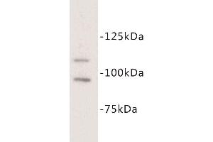 Western Blotting (WB) image for anti-Mast/stem Cell Growth Factor Receptor (KIT) antibody (ABIN1854841) (KIT antibody)