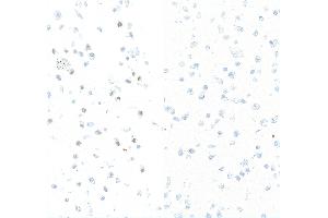 Immunocytochemistry (ICC) image for anti-Replication Protein A2, 32kDa (RPA2) (pSer4), (pSer8) antibody (ABIN7453379) (Recombinant RPA2 antibody  (pSer4, pSer8))