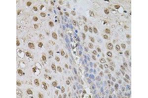 Immunohistochemistry of paraffin-embedded Human esophagus using Cyclin A2 Polyclonal Antibody at dilution of 1:100 (40x lens). (Cyclin A antibody)