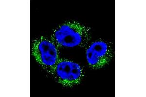 Confocal immunofluorescent analysis of M1 Antibody (Center) 2036c with  cell followed by Alexa Fluor 488-conjugated goat anti-rabbit lgG (green). (AP1M1 antibody  (AA 199-227))