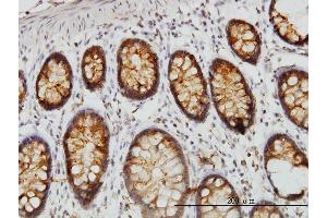 Immunoperoxidase of monoclonal antibody to DARS on formalin-fixed paraffin-embedded human colon. (DARS antibody  (AA 393-500))