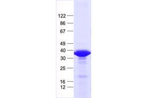Validation with Western Blot