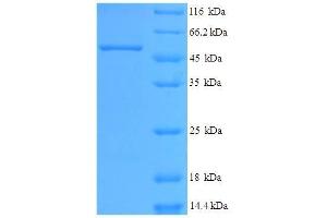 Gastric Intrinsic Factor (Vitamin B Synthesis) (GIF) (AA 19-417) protein (His tag) expressed in E. (Intrinsic Factor Protein (AA 19-417) (His tag))