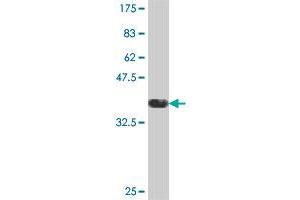 Western Blot detection against Immunogen (36. (ASAP2 antibody  (AA 909-1006))