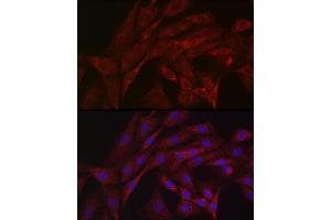 Immunofluorescence analysis of NIH/3T3 cells using Parkin Rabbit pAb (ABIN6132295, ABIN6145226, ABIN6145227 and ABIN6215092) at dilution of 1:50 (40x lens). (Parkin antibody  (AA 1-300))