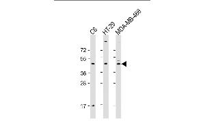 All lanes : Anti-GSK3BAntibody at 1:2000 dilution Lane 1: C6 whole cell lysate Lane 2: HT-29 whole cell lysate Lane 3: MDA-MB-468 whole cell lysate Lysates/proteins at 20 μg per lane. (GSK3 beta antibody  (AA 2-33))