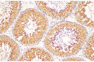 Immunohistochemistry (Paraffin-embedded Sections) (IHC (p)) image for anti-Lactate Dehydrogenase C (LDHC) antibody (ABIN7234324)