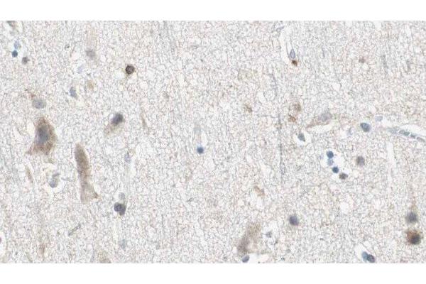 DZIP3 antibody  (Internal Region)