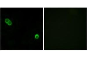 Immunofluorescence analysis of MCF7 cells, using PHCA Antibody. (ACER3 antibody  (AA 171-220))