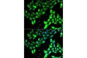 Immunofluorescence analysis of A549 cell using KIF2B antibody. (KIF2B antibody)