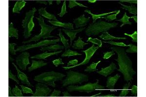Immunofluorescence of monoclonal antibody to SRGAP1 on HeLa cell. (SRGAP1 antibody  (AA 952-1050))